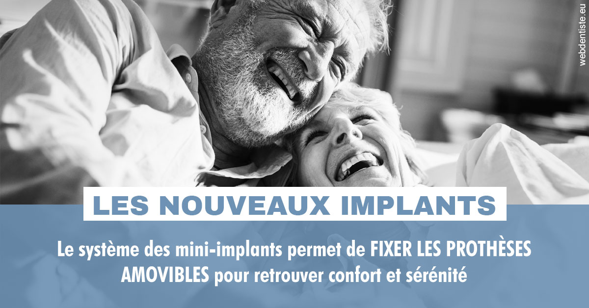 https://dr-bealem-borris.chirurgiens-dentistes.fr/Les nouveaux implants 2