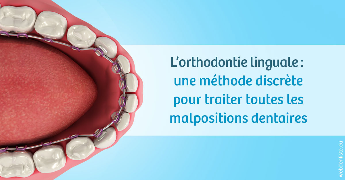 https://dr-bealem-borris.chirurgiens-dentistes.fr/L'orthodontie linguale 1