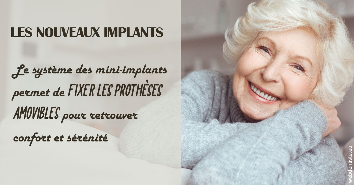 https://dr-bealem-borris.chirurgiens-dentistes.fr/Les nouveaux implants 1
