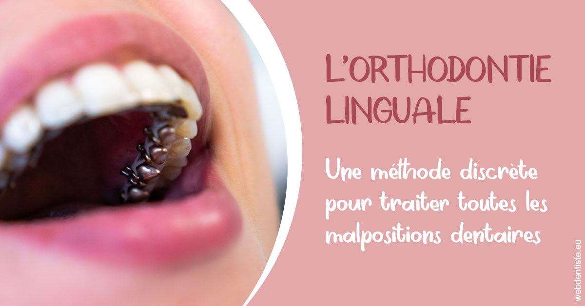 https://dr-bealem-borris.chirurgiens-dentistes.fr/L'orthodontie linguale 2