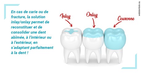 https://dr-bealem-borris.chirurgiens-dentistes.fr/L'INLAY ou l'ONLAY