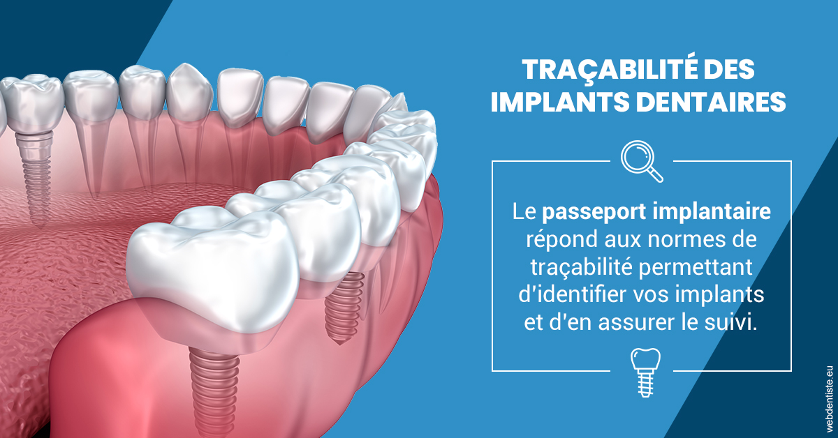 https://dr-bealem-borris.chirurgiens-dentistes.fr/T2 2023 - Traçabilité des implants 1