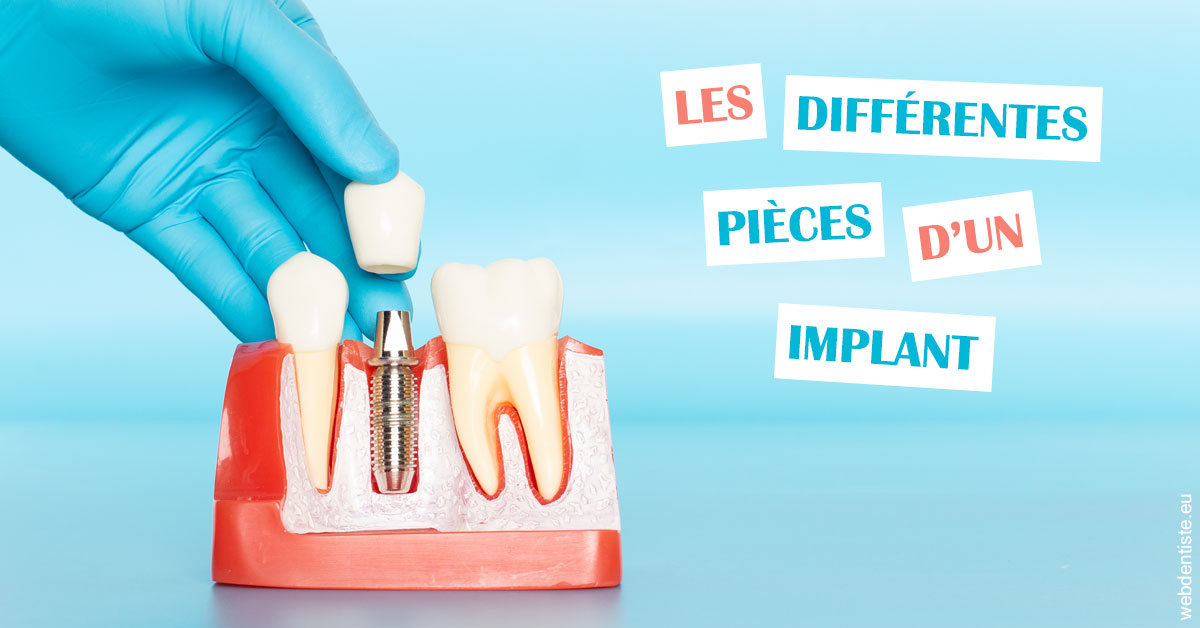 https://dr-bealem-borris.chirurgiens-dentistes.fr/Les différentes pièces d’un implant 2
