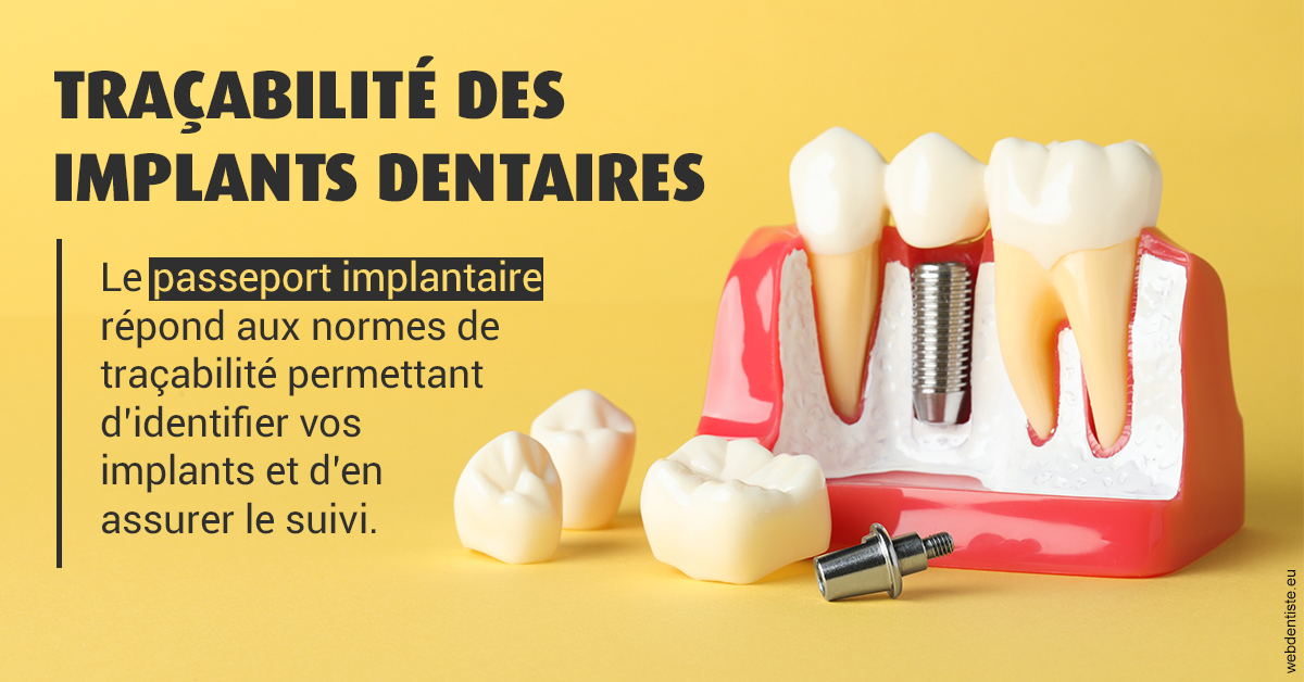 https://dr-bealem-borris.chirurgiens-dentistes.fr/T2 2023 - Traçabilité des implants 2