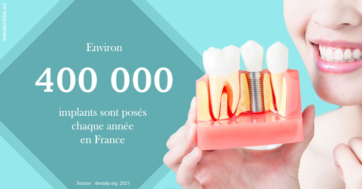 https://dr-bealem-borris.chirurgiens-dentistes.fr/Pose d'implants en France 2