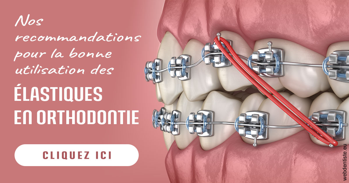 https://dr-bealem-borris.chirurgiens-dentistes.fr/Elastiques orthodontie 2